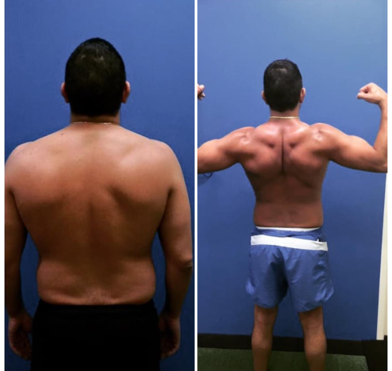 Muscle Tone 3 Before And After